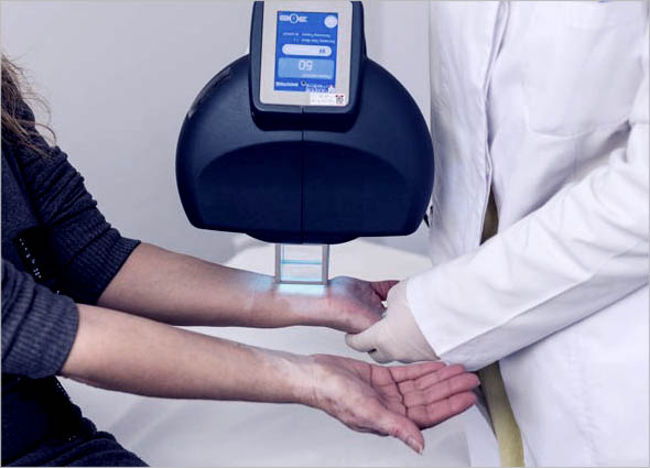  UVB Therapy 