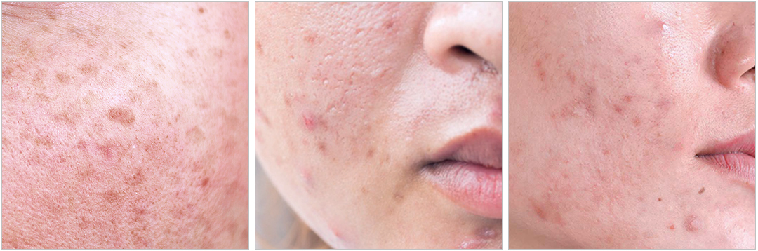 skin conditions