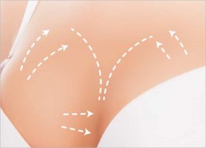 BENEFITS OF BREAST AUGMENTATION
