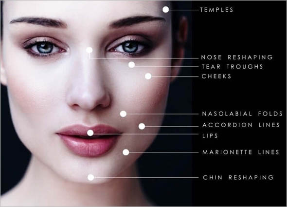 ELLANSE DERMAL FILLER