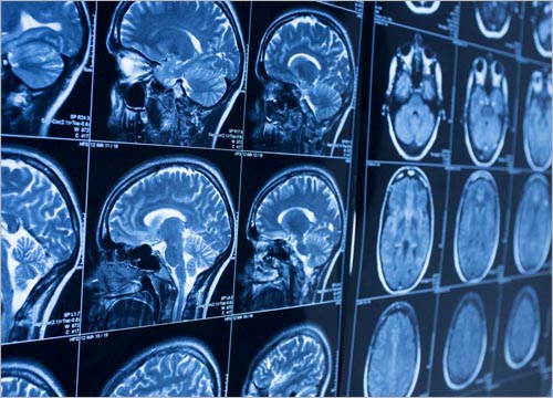 Benefits of Celebre Placenta & Stem Cell