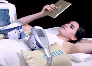 Benefits of Clatuu Fat Freezing Treatment