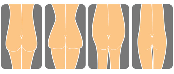 Buttock filler