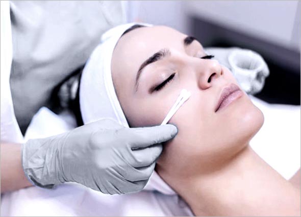 Chemical Skin Peel 