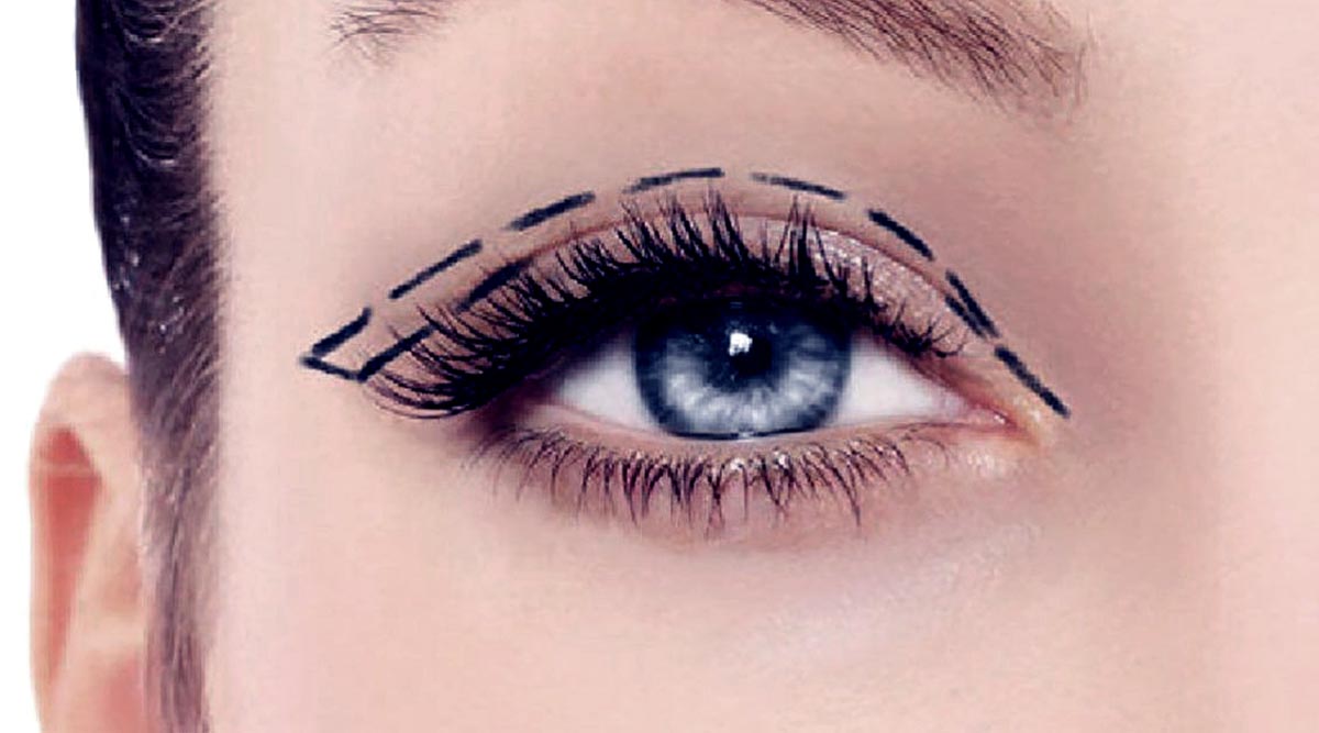 Double Eyelid Non-Invasive Surgery