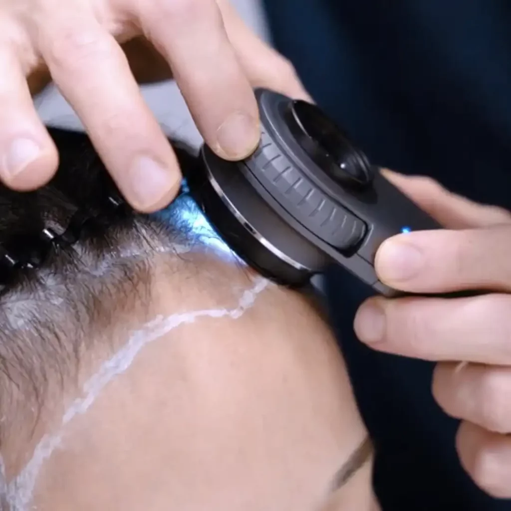 Our Expert, Award-Winning Doctors and medical teams have completed thousands of successful hair restoration cases