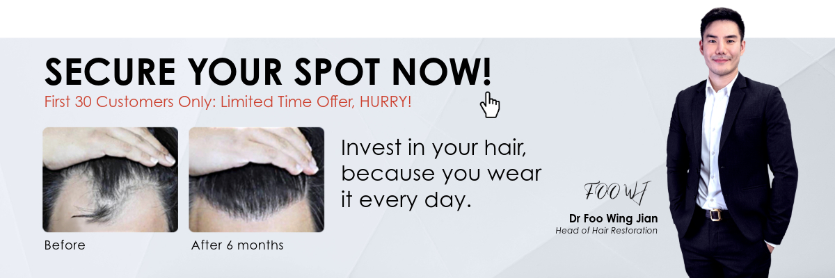 Limited-time offer on hair loss restoration plan for the first 30 customers