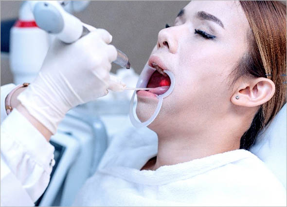 Fotona Laser Snoring Treatment