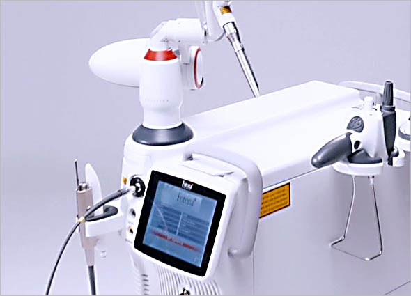 Fotona Laser Snoring Treatment