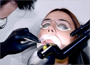 Fotona Laser Snoring Treatment