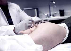 Genital Skin Whitening for Men