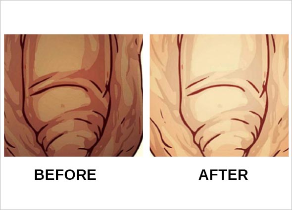 Genital Skin Whitening for Men