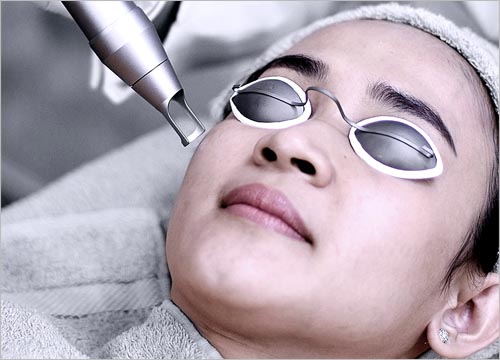 BENEFITS OF PICO LASER
