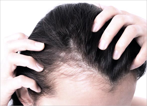 Hair Filler Gel - Hair Treatment