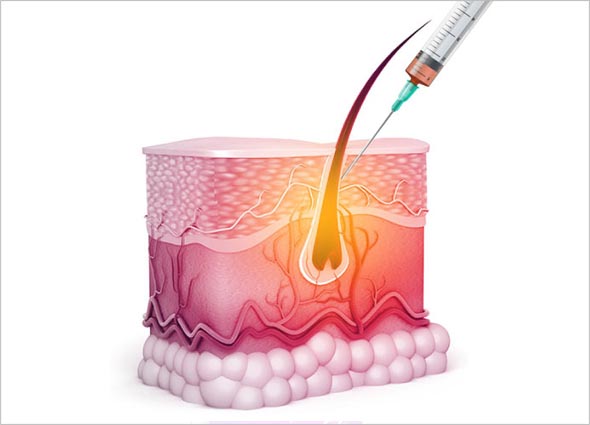 Hair Filler Gel - Hair Treatment