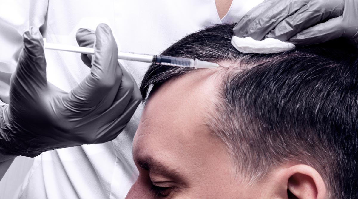 HAIR FILLER GEL – HAIR TREATMENT
