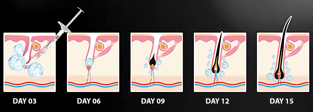 Hair Filler Gel - Hair Treatment