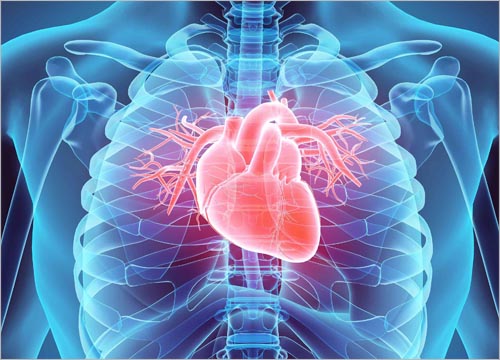 Heart Disease