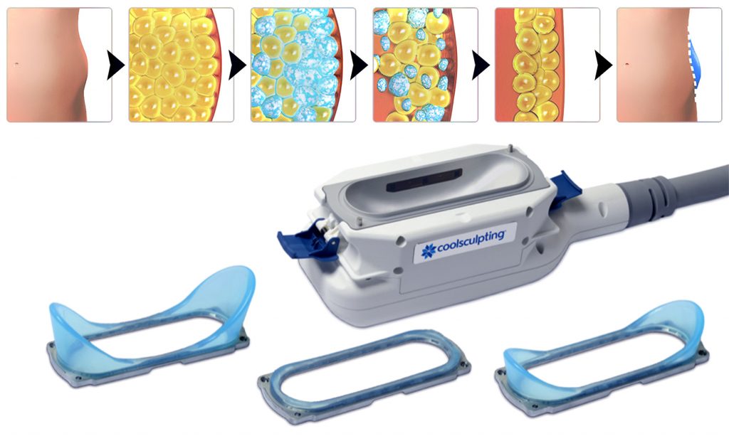 How Does Zeltiq Cooladvantage Work
