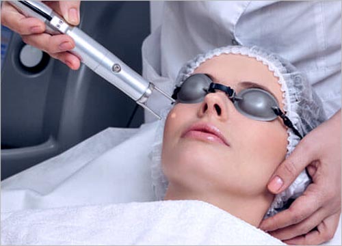 How Does the Fractional CO2 Laser Work