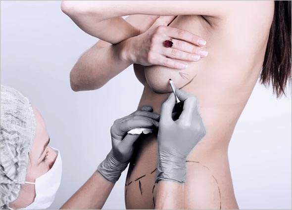 How does Breast Augmentation work