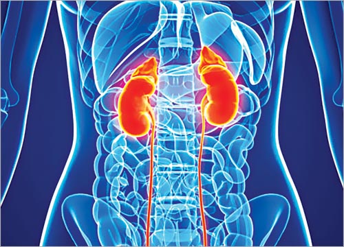 Kidney Disease