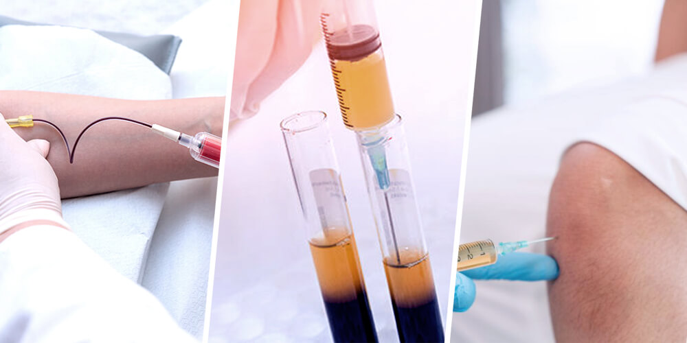 Knee PRP