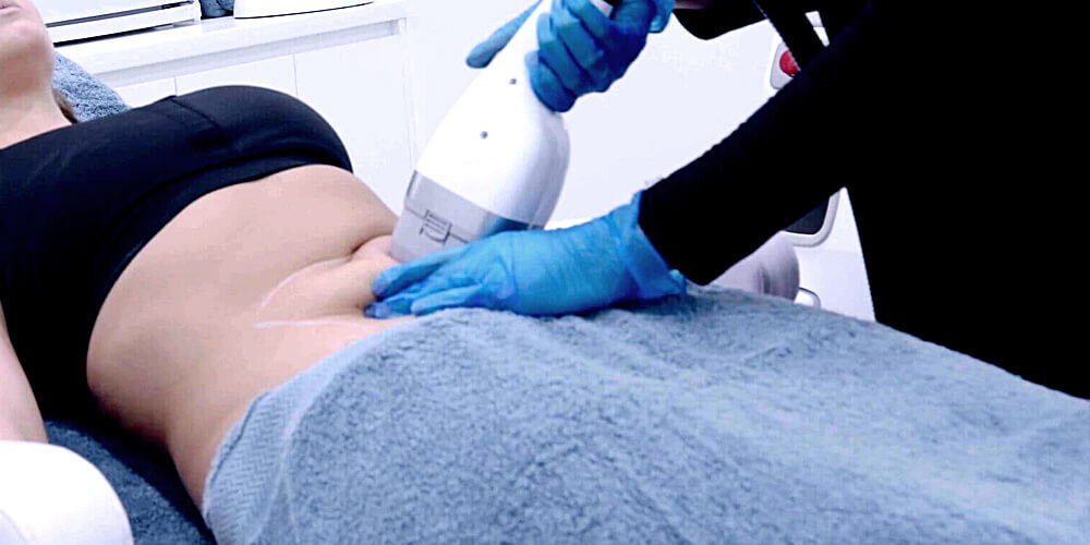 LIPOCEL HIFU