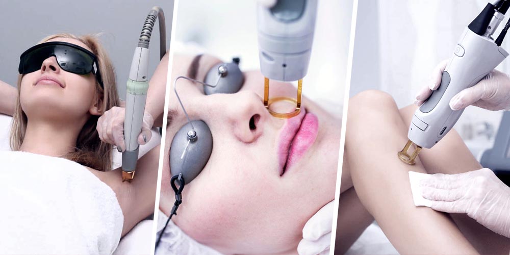 Laser Hair Removal