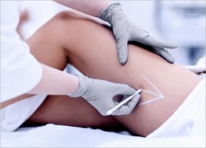 Mesolipo Fat Melting Slimming Injection