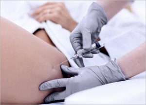 Mesolipo Fat Melting Slimming Injection
