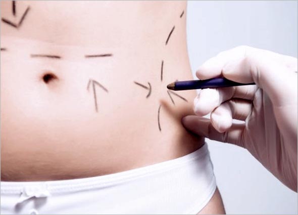 MESOLIPO FAT MELTING SLIMMING INJECTION