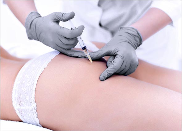 MESOLIPO FAT MELTING SLIMMING INJECTION