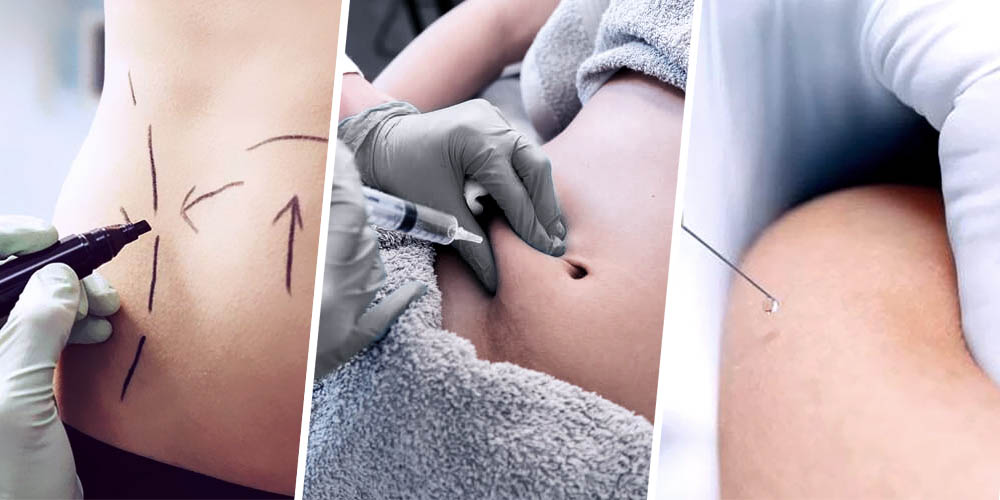 Mesolipo Injection