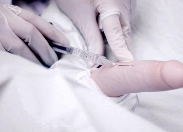 Penis Enlargement Treatment