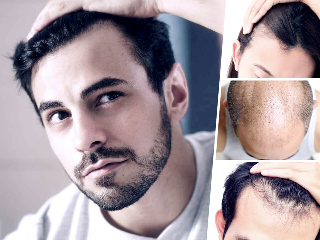 Premier Hair Losss Treatments Main Banner