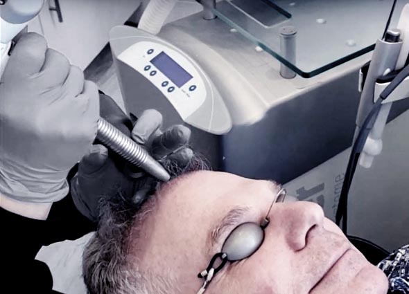Premier Signature Hair Growth Laser Treatment