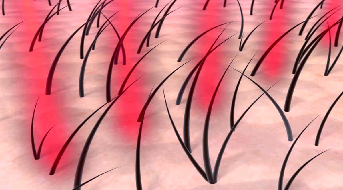 Premier Signature Hair Growth Laser Treatment
