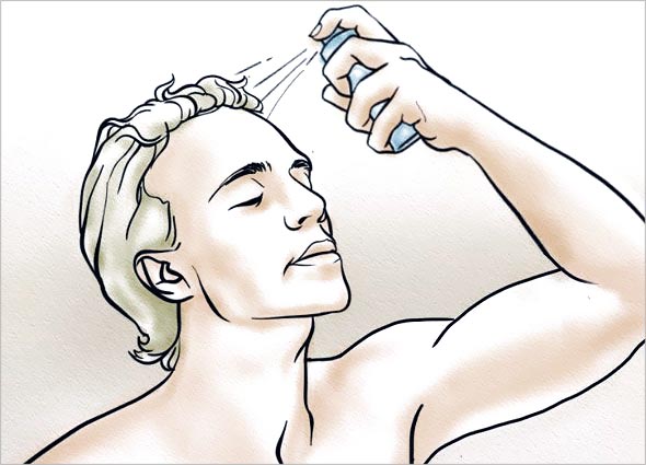 Regro (Minoxidil) Spray