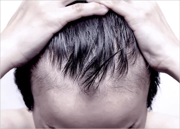 Regro (Minoxidil) Spray
