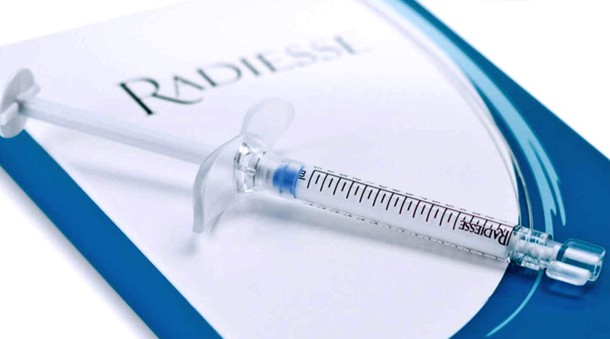 Radiessse Filler Injection