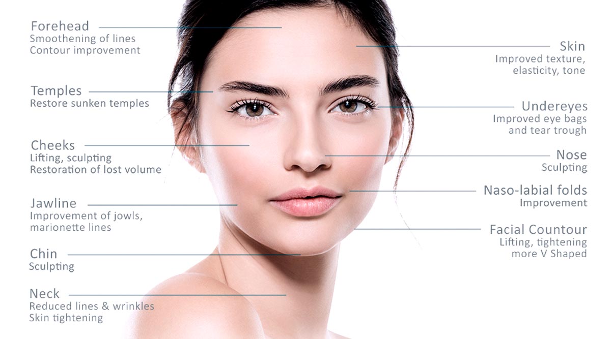 Radiessse Filler Injection