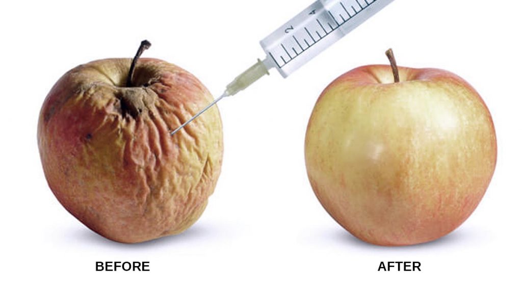 Scrotum Botulinum Toxin