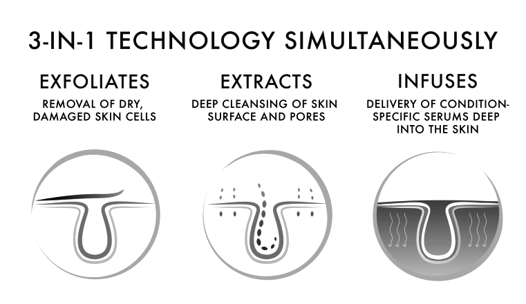 SilkPeel & Dermalinfusion