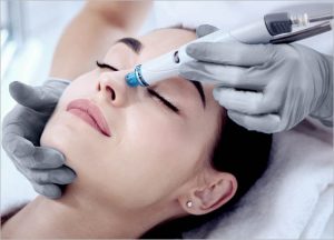 SilkPeel & Dermalinfusion