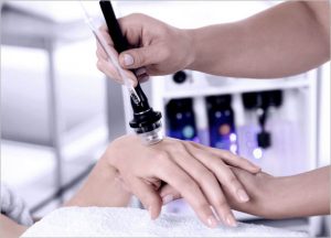 SilkPeel & Dermalinfusion
