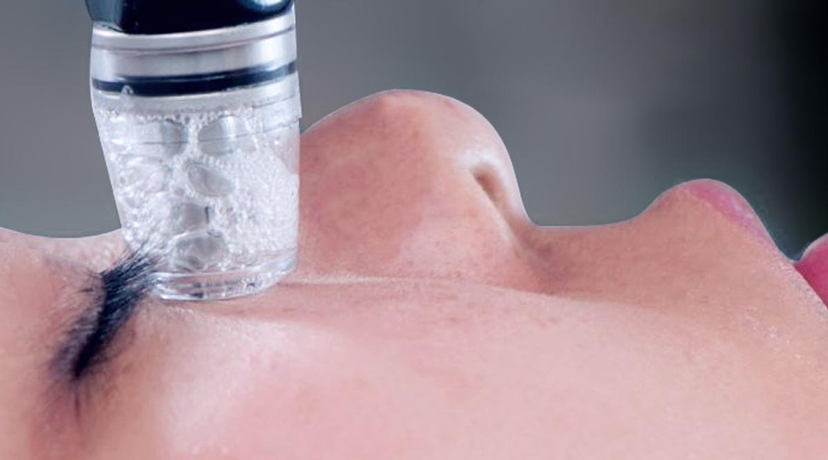 SilkPeel & Dermalinfusion Treatment 07