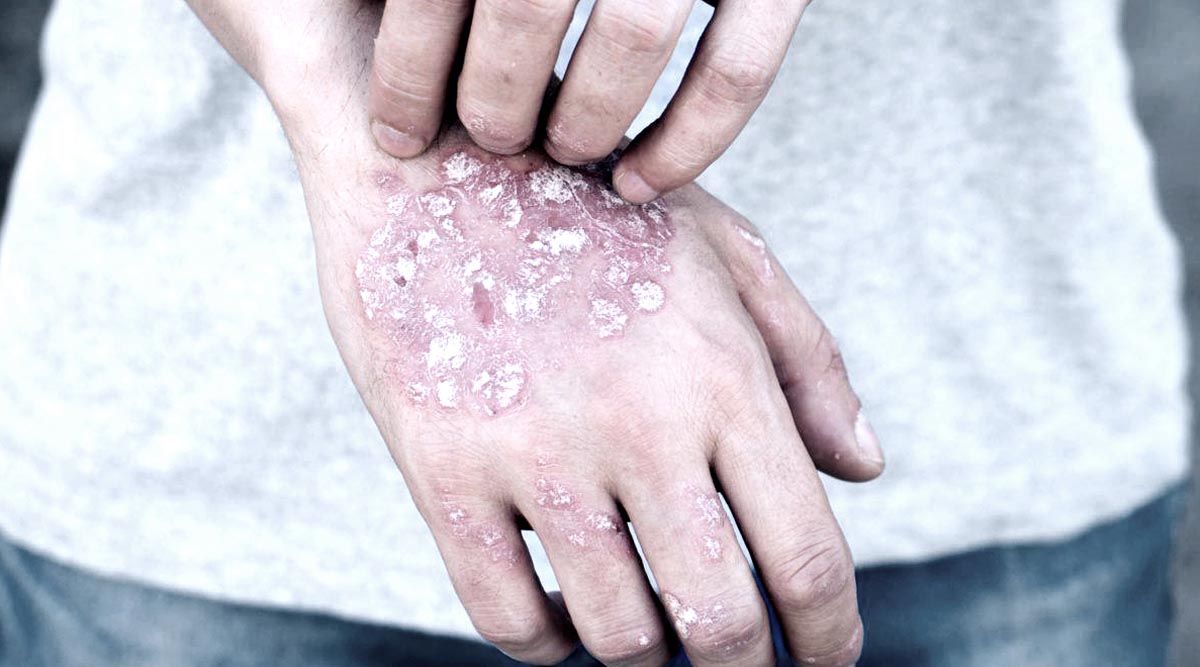 Skin Disease Consultation