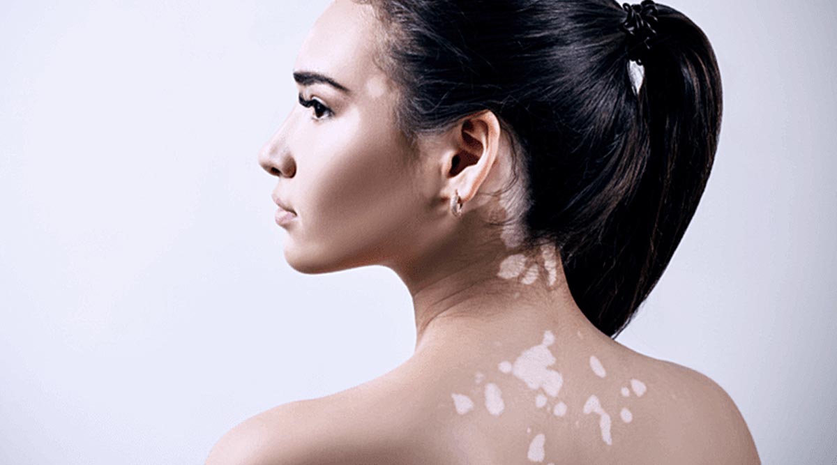 Skin Disease Consultation Premier Clinic 02