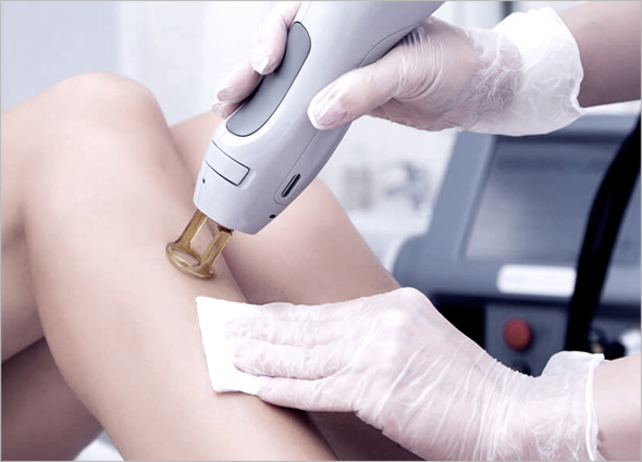 Skin Fungal Infection Laser